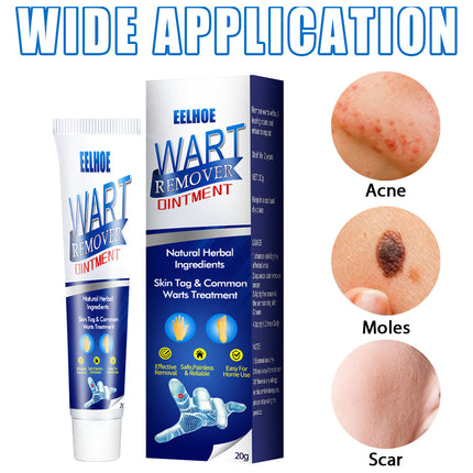 WartAway Herbal Cream