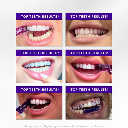 WhiteSmile Teeth Whitening Strips (14 Strips)