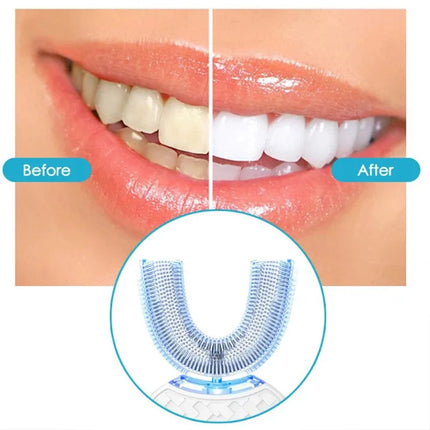 SonicSmile™ 360° Automatic U-Shape Electric Toothbrush