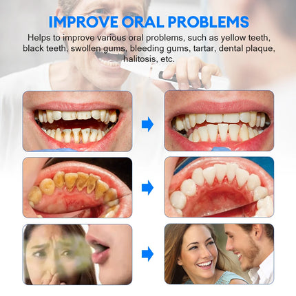 Electric Teeth Cleaner & Stain Remover