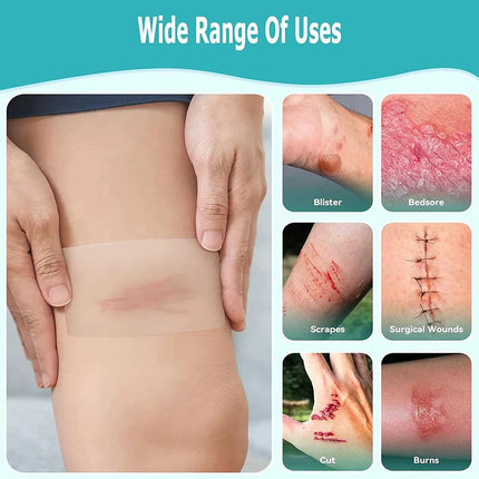 Hydrocolloid Dressing Roll