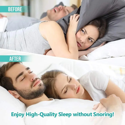 ANTI SNORING DEVICES