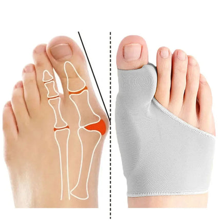 Premium Bunion Corrector Sock