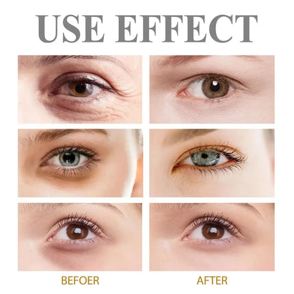 Instant Eye Tightener