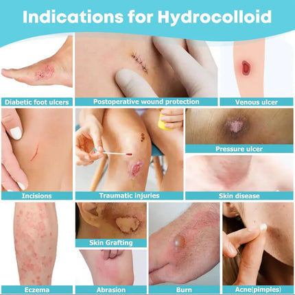 Hydrocolloid Dressing Roll