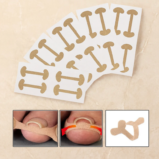 Toenail Correction Strips