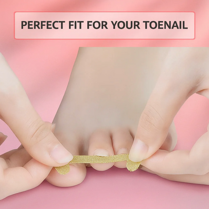Toenail Correction Strips
