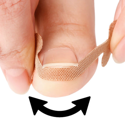 Toenail Correction Strips